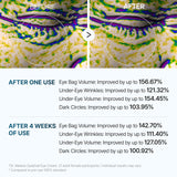 Under Eye Cream – EGF Repair Treatment for Dark Circles & Fine Lines