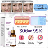 Bakuchiol Serum – Retinol Alternative Anti-Aging Face Serum for Youthful Skin