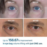 Under Eye Cream – EGF Repair Treatment for Dark Circles & Fine Lines