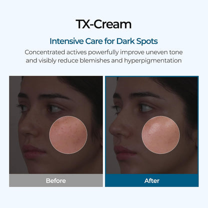 GlowFade™ TX Tranexamic Acid Cream – Korean Anti-Pigmentation &amp; Freckle Corrector for Clear, Even-Toned Skin (50ml)