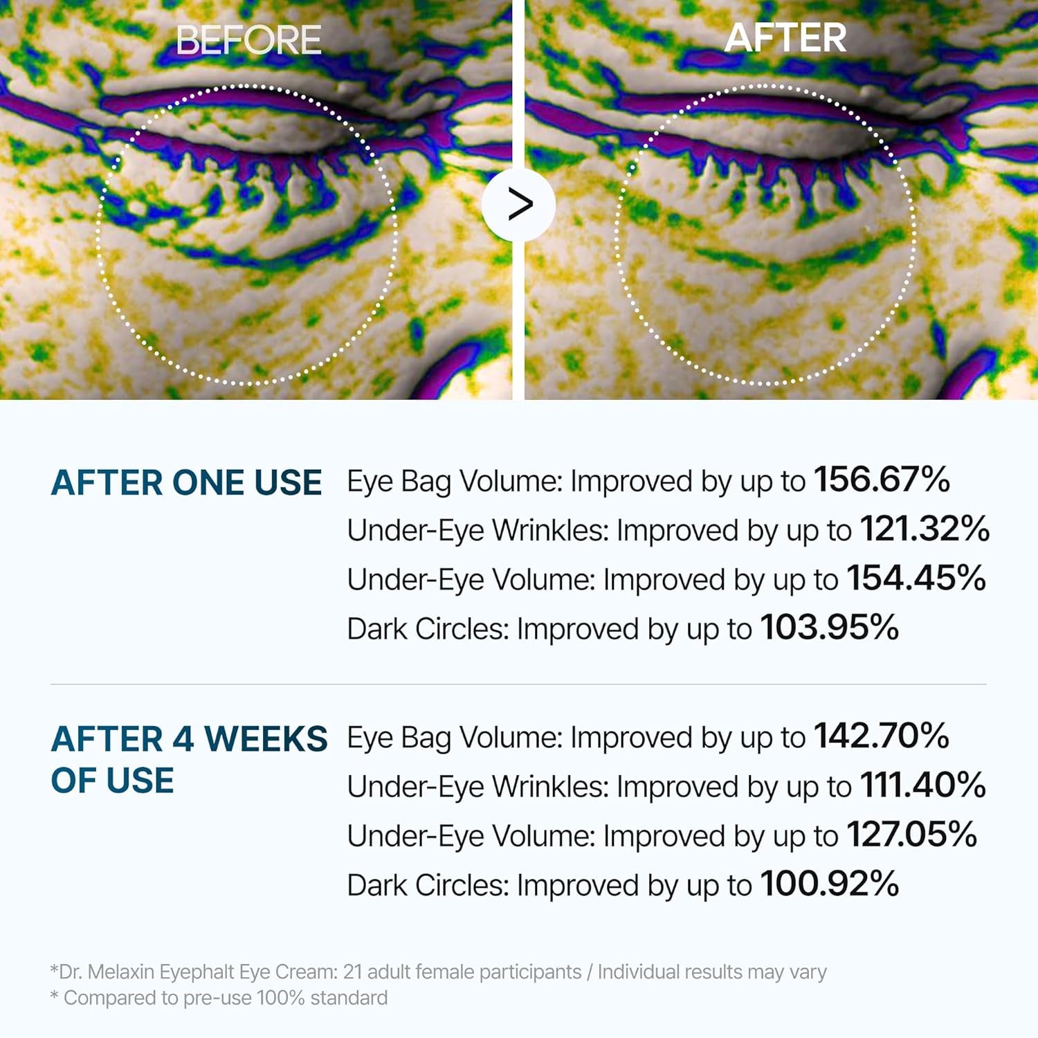 Under Eye Cream – EGF Repair Treatment for Dark Circles &amp; Fine Lines