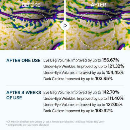 Under Eye Cream – EGF Repair Treatment for Dark Circles &amp; Fine Lines