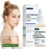 Transform Your Skin with Lactobionic Acid Shrink Pores Serum - Fade Fine Lines, Firm and Nourish for Radiant Skin!