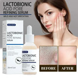 Transform Your Skin with Lactobionic Acid Shrink Pores Serum - Fade Fine Lines, Firm and Nourish for Radiant Skin!