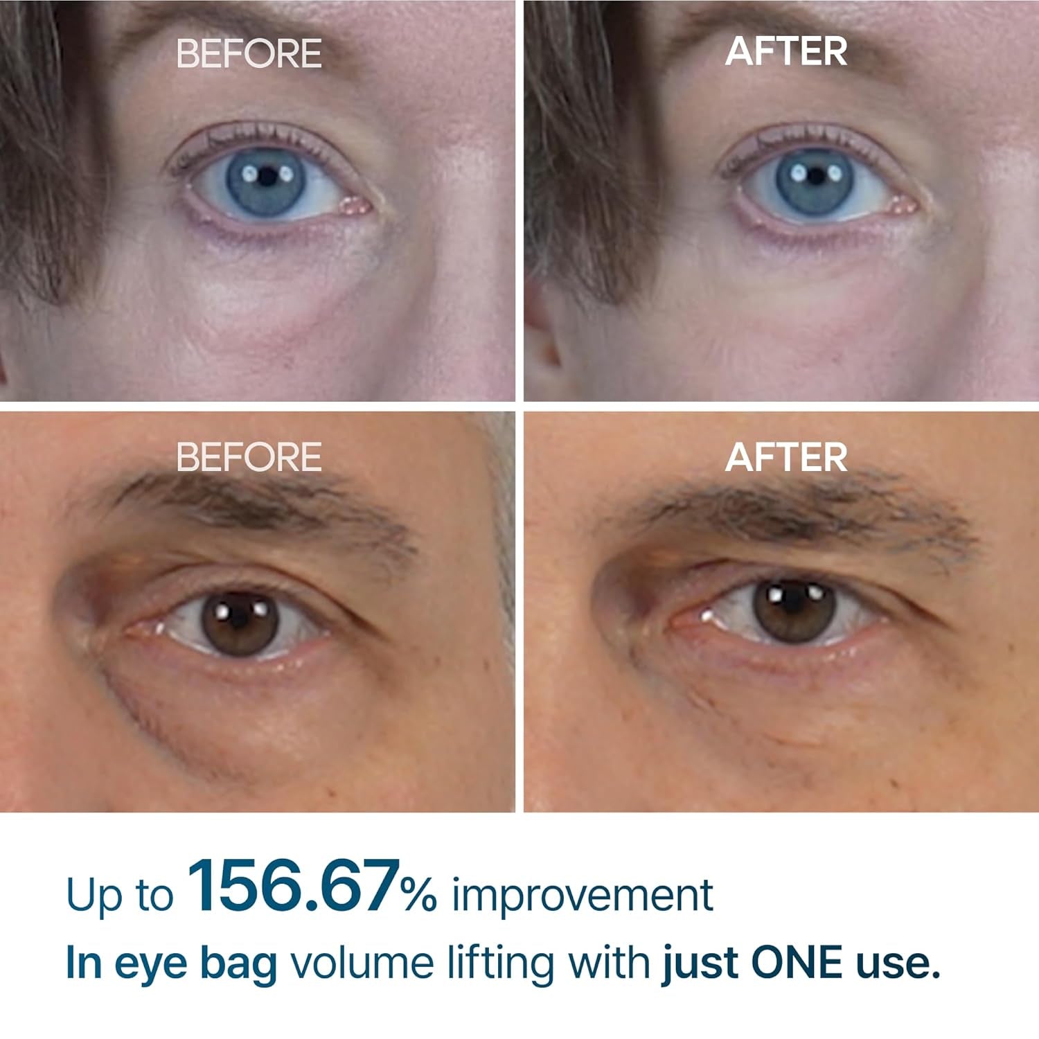 Under Eye Cream – EGF Repair Treatment for Dark Circles &amp; Fine Lines