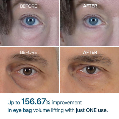 Under Eye Cream – EGF Repair Treatment for Dark Circles &amp; Fine Lines