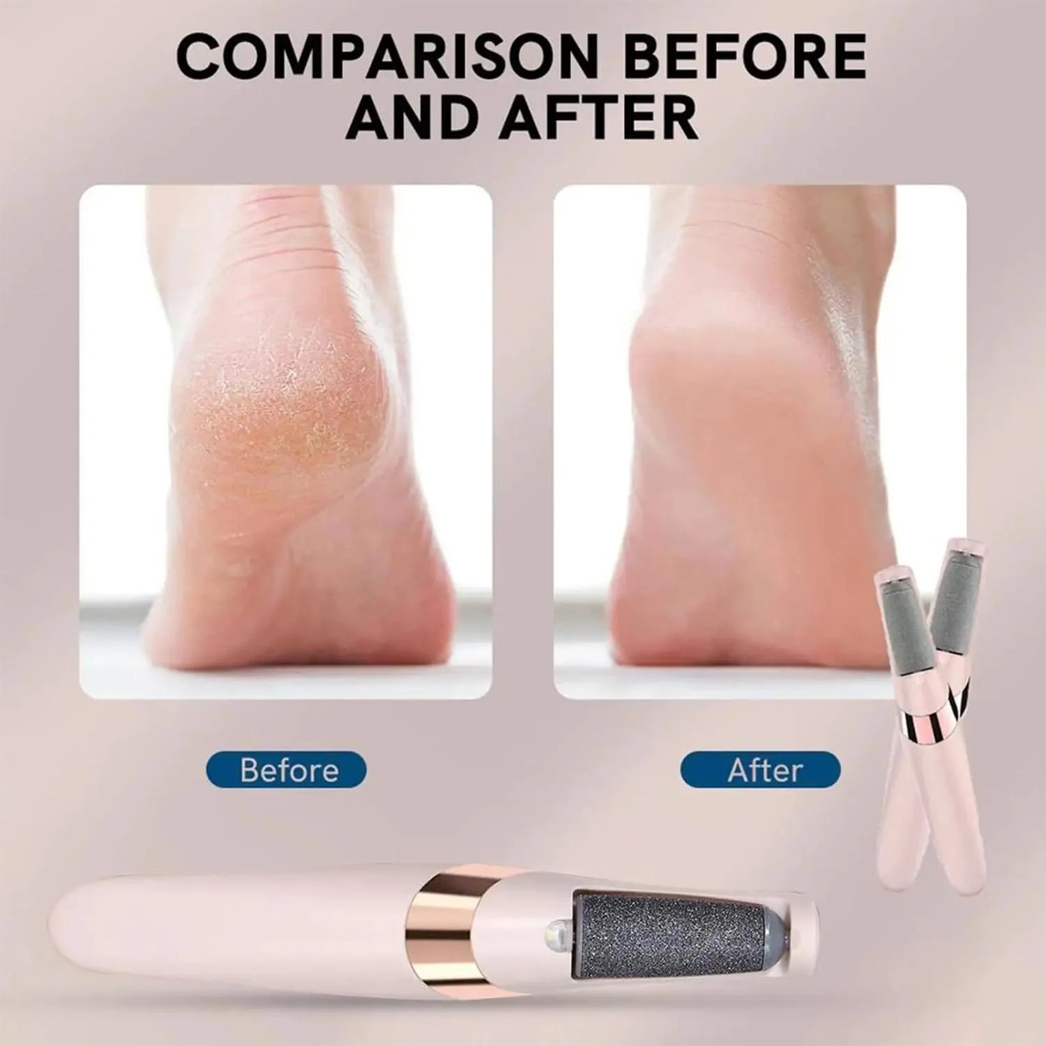 Electric Pedicure Callus Remover Tool for Hard Skin &amp; Foot Care
