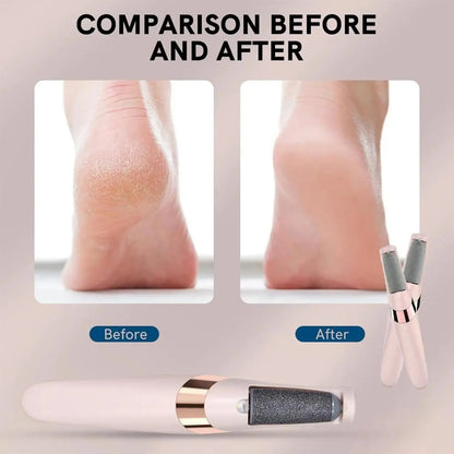 Electric Pedicure Callus Remover Tool for Hard Skin &amp; Foot Care
