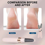 Electric Pedicure Callus Remover Tool for Hard Skin & Foot Care