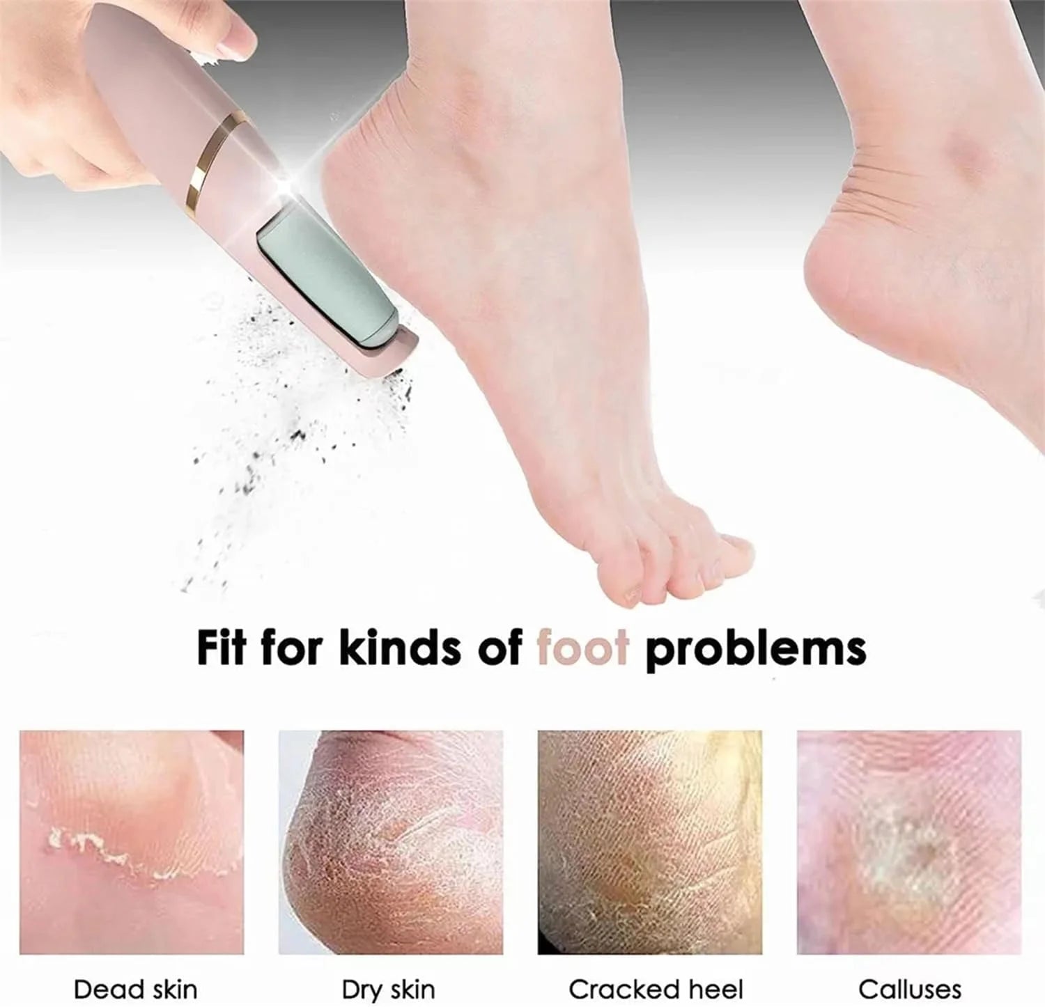 Electric Pedicure Callus Remover Tool for Hard Skin &amp; Foot Care
